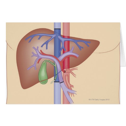 Patients Bypass Heart Attack Cards transplant Greeting liver Gifts Shirts quotes  inspirational T For