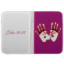 Loving Hands - John 20:27 Kindle Keyboard Cases