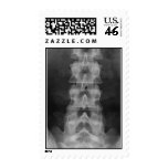 lumbar_spine_01 postage