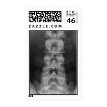 lumbar_spine_01 postage by jeffsdx lumbar_spine_01 postage