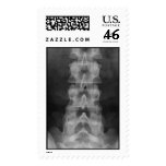 Lumbar Spine X-ray postage
