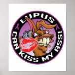 Lupus Can Kiss My Ass Print