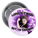 Lupus is Tough...But I'm Tougher Pinback Buttons