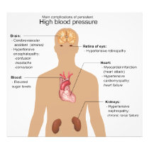Main Complications of High Blood Pressure Chart Art Photo