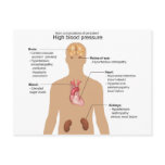 Main Complications of High Blood Pressure Chart postcards