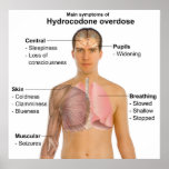 Main Symptoms of a Hydrocodone Overdose Chart Posters