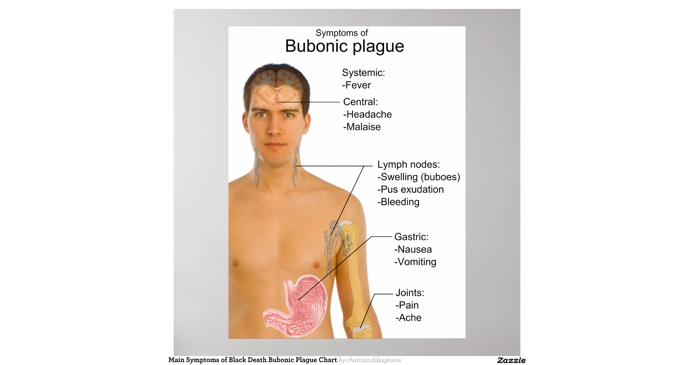main_symptoms_of_black_death_bubonic_plague_chart_poster