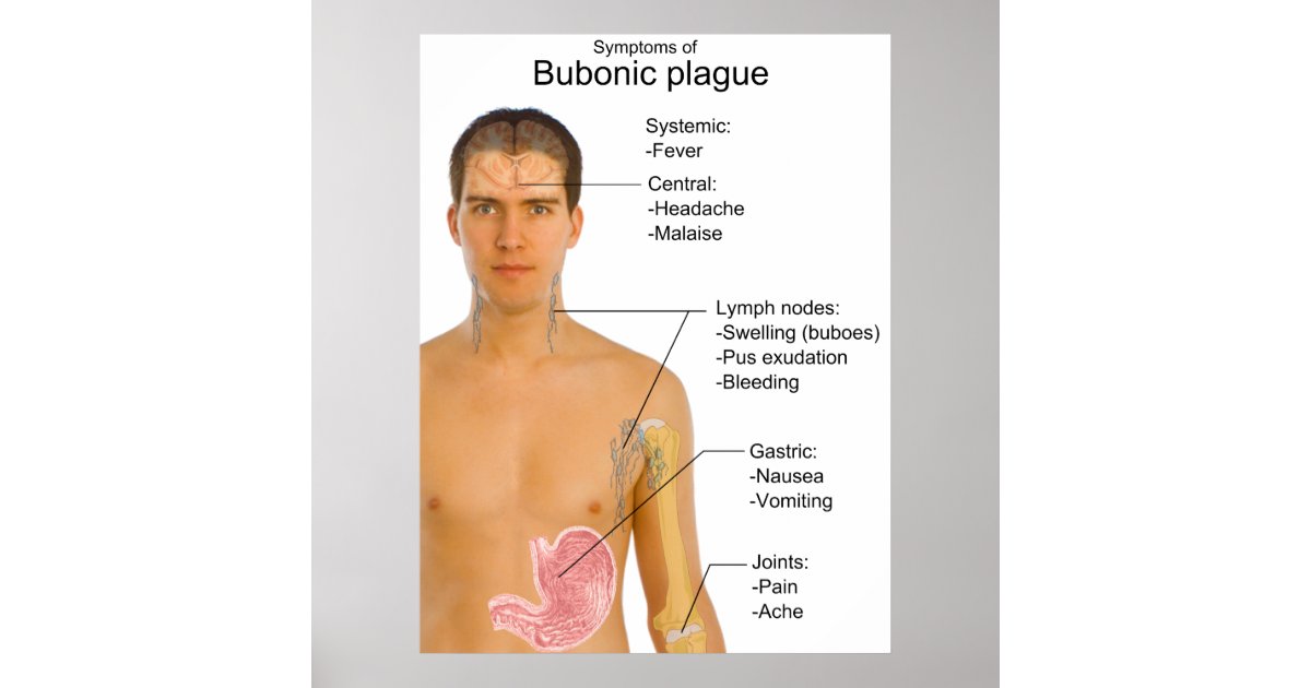 Main Symptoms of Black Death Bubonic Plague Chart Poster | Zazzle