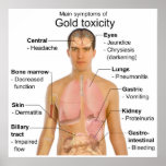 Main Symptoms of Gold Toxicity in Humans Chart posters