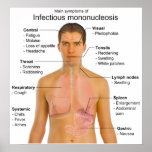 Main Symptoms of Infectious Mononucleosis Chart posters
