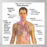 Main Symptoms of Infectious Pneumonia Diagram posters