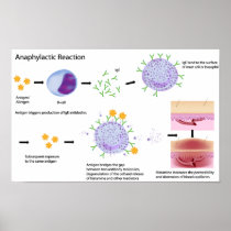 Mechanism of Allergy Poster