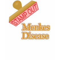 Menkes Disease t-shirts by shopaholicchick Menkes Disease t-shirts