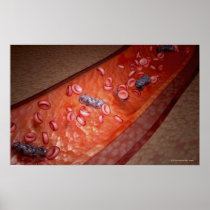 Microscopic rendering of a blood infection