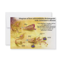 Microtubules Desintegration in Alzheimer's Disease Custom Announcements