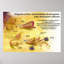 Microtubules Desintegration in Alzheimer's Disease Print