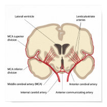Middle cerebral artery  Poster