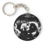 My First Baby Picture keychains