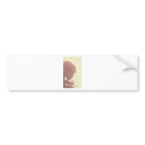Official Pateint: Richard merch Bumper Stickers