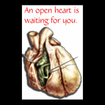Open Heart posters