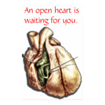 Open Heart posters