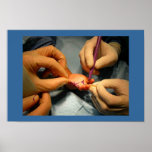 Pediatric Hand Surgery Print