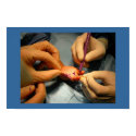Pediatric Hand Surgery posters