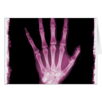 Pink X-ray Skeleton Hand Greeting Cards
