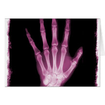 Pink X-ray Skeleton Hand Greeting Cards