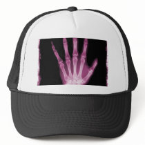 Pink X-ray Skeleton Hand Trucker Hats
