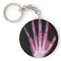 Pink X-ray Skeleton Hand Key Chains