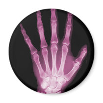 Pink X-ray Skeleton Hand Magnets