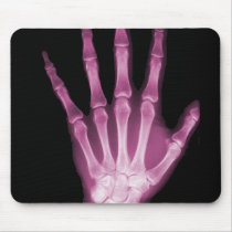 Pink X-ray Skeleton Hand Mousepad