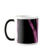 Pink X-ray Skeleton Hand Coffee Mug