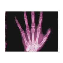 Pink X-ray Skeleton Hand Post Card