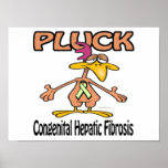 Pluck Congenital Hepatic Fibrosis Print
