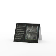 Poetry - Will you still love me card