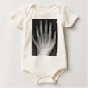 Polydactyly, Six Fingered Hand, X-Ray, rarity! t-shirts by harlowandcompany Polydactyly, Six Fingered Hand, X-Ray, rarity! t-shirts