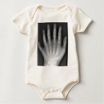 Polydactyly, Six Fingered Hand, X-Ray, rarity! t-shirts by harlowandcompany Polydactyly, Six Fingered Hand, X-Ray, rarity! t-shirts