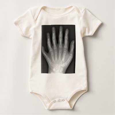 Polydactyly Six Fingered Hand XRay rarity T Shirts by harlowandcompany