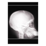 Prescription Invite w/Foot In Mouth X-ray