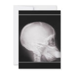 Prescription Invite w/Foot In Mouth X-ray