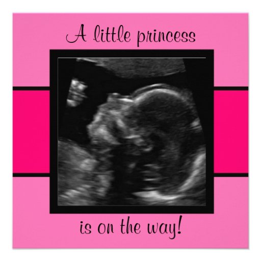 Princess Baby Customized Ultrasound Photo Template Invite