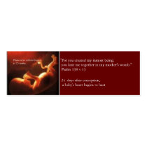 Prolife Card business cards