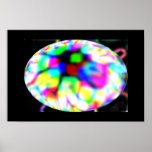 Pupil Poster