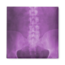 Purple Digital X-Ray Art Magnet by chiropracticbydesign Purple Digital X-Ray Art Magnet