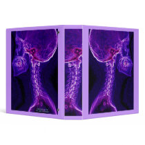 Purple/Fushia C-spine X-ray binder