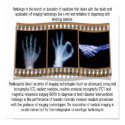 RADIOLOGY - XRAY POSTER - HAND, OK, HANDSHAKE posters
