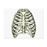 Rib Cage Bronze Post Card
