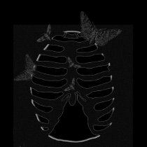 Ribcage Moth Babydoll Tee t-shirts